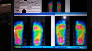 インソール測定結果
